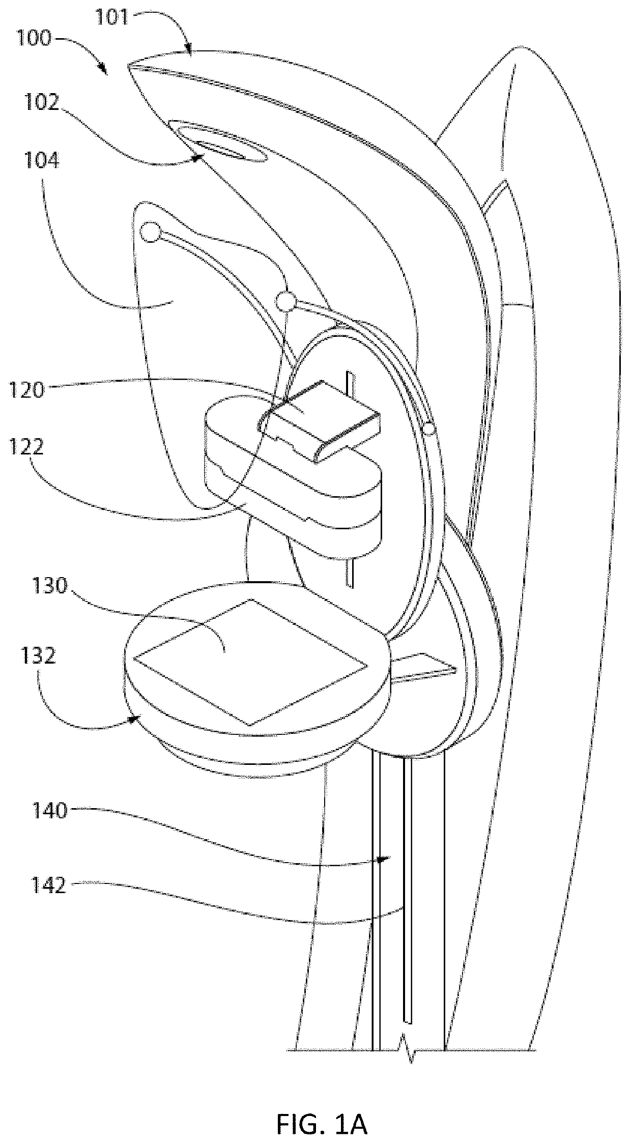 System and method for breast cancer detection using co-localized ultrasound-mammography