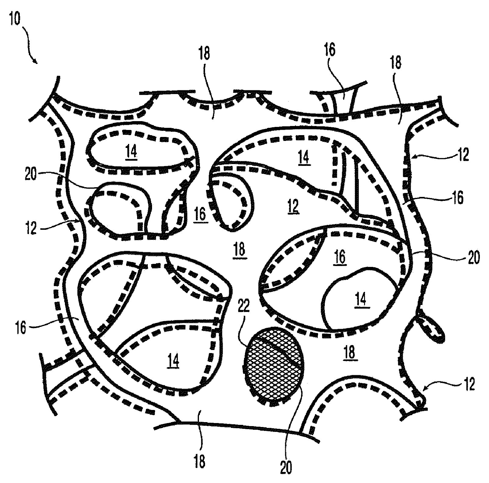 At least partially resorbable reticulated elastomeric matrix elements and methods of making same