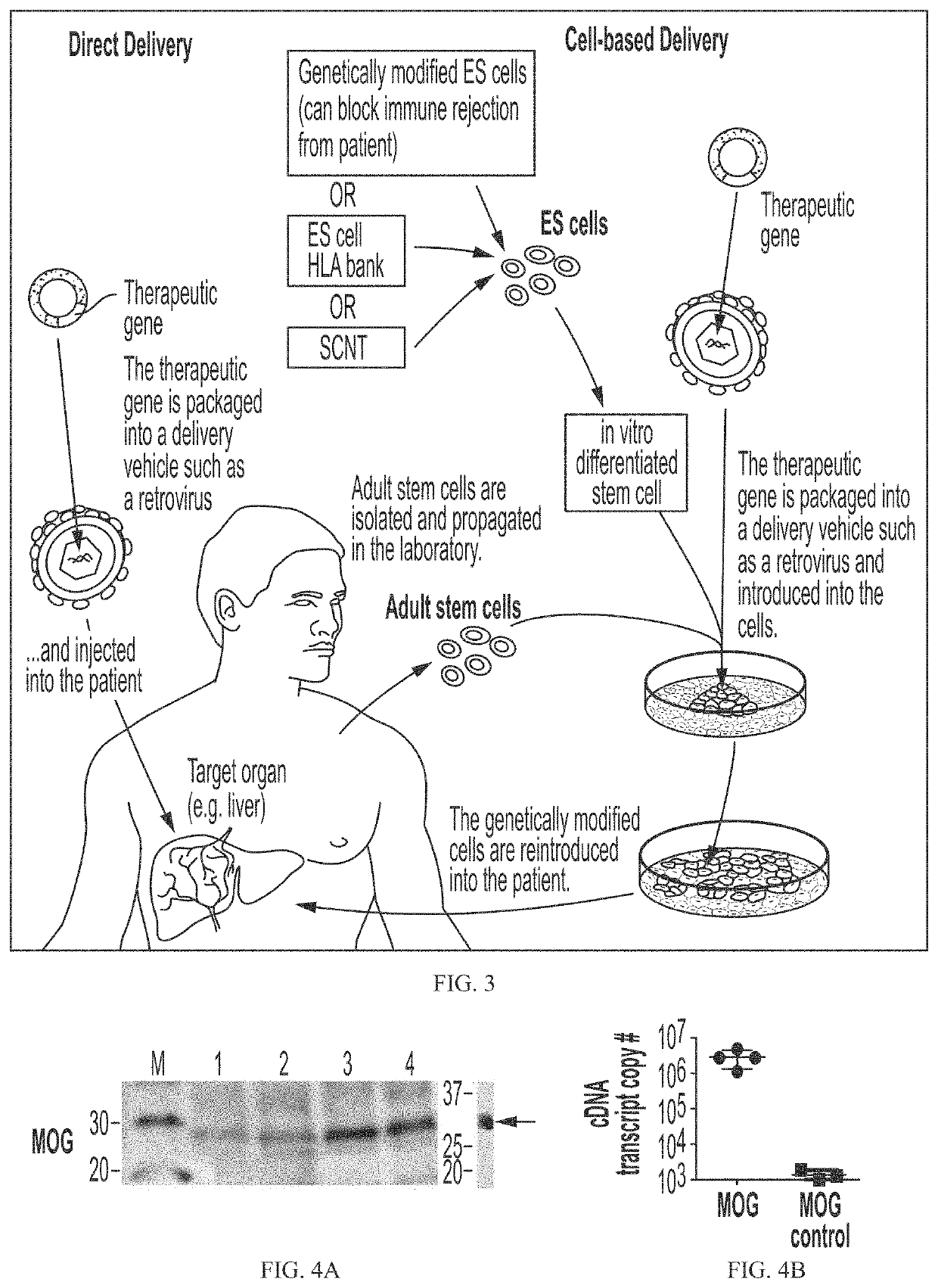 Aav-based gene therapy for multiple sclerosis