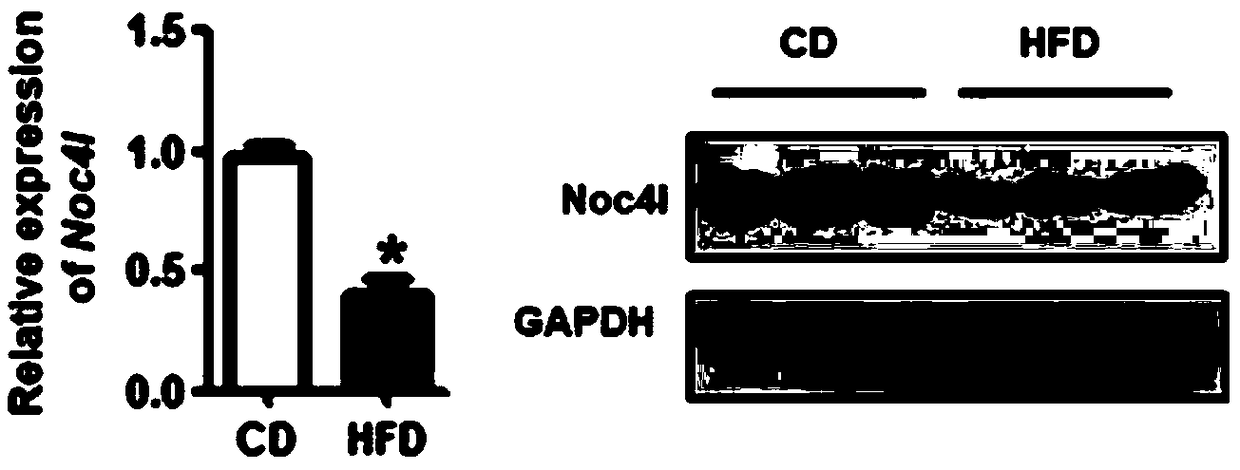 Application of NOC4L protein as nonalcoholic fatty liver biomarker and therapeutic target