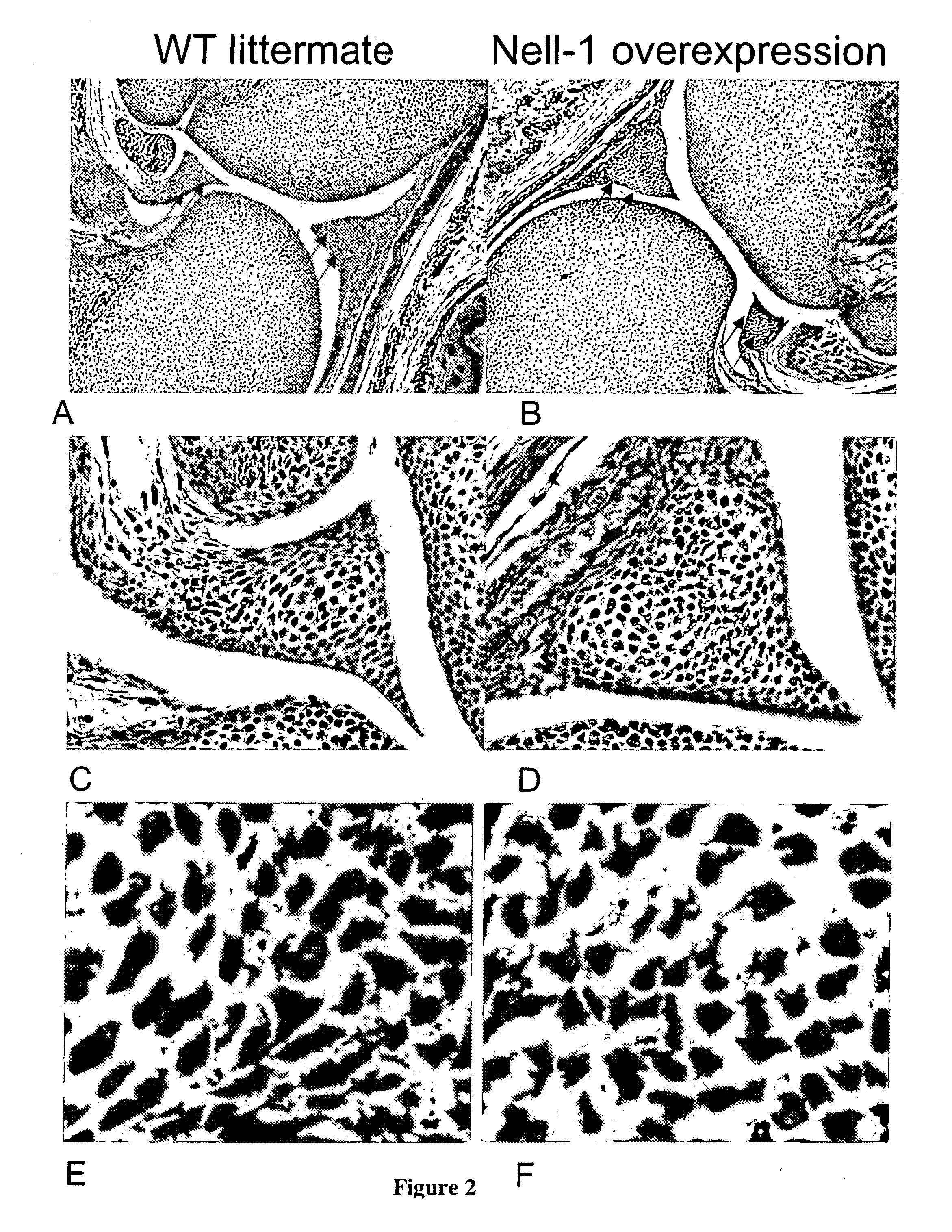 Composition for Promoting Cartilage Formation or Repair Comprising a NELL Gene Product and Method of Treating Cartilage-Related Conditions Using Such Composition