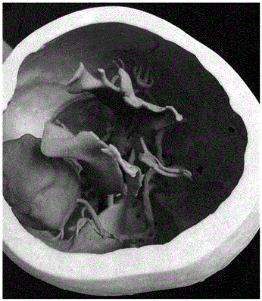 DTI (Diffusion Tensor Imaging)-based cranial nerve fiber bundle three-dimensional rebuilding method