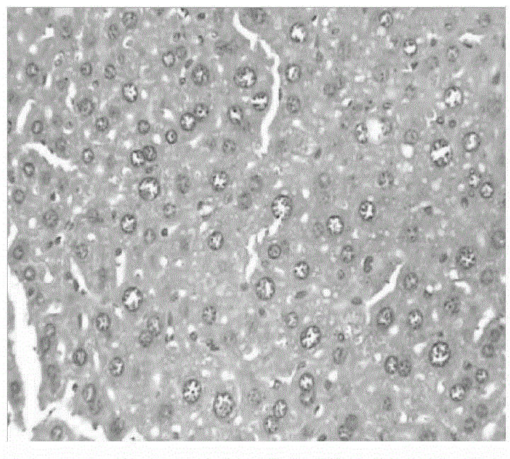 Method for establishing mouse model with hepatic preneoplastic lesion caused by double factors of alcohol and HBV