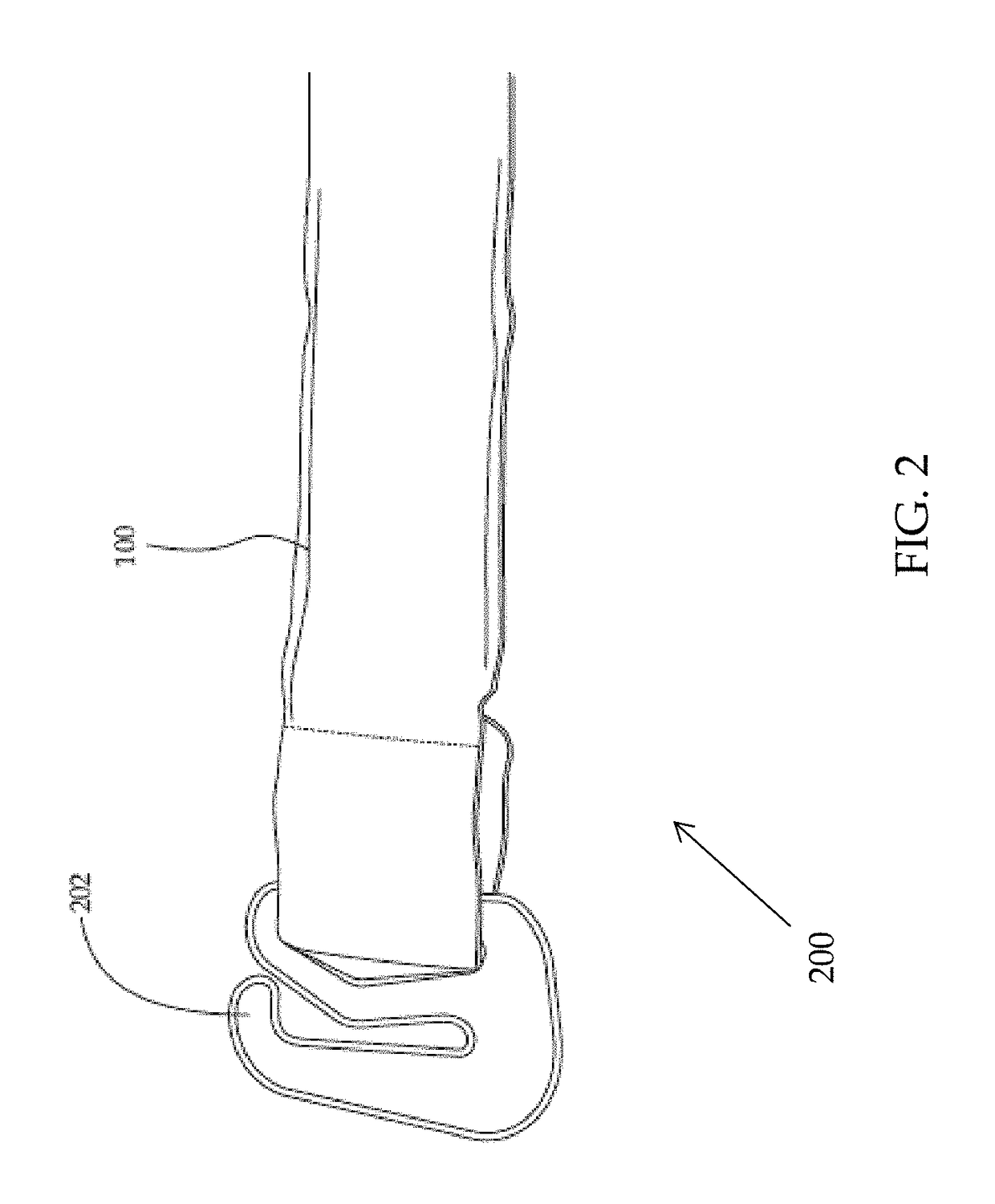 Apparatus and method for window treatment management