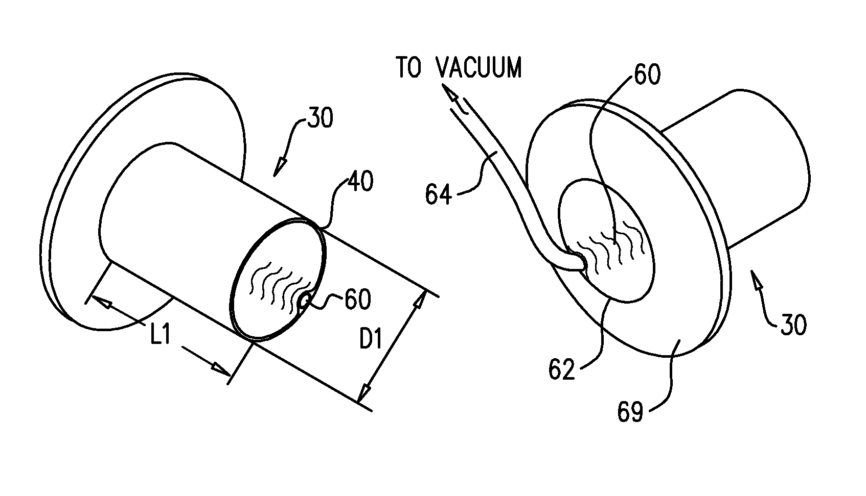 Surgical techniques and closure devices for direct cardiac catheterization