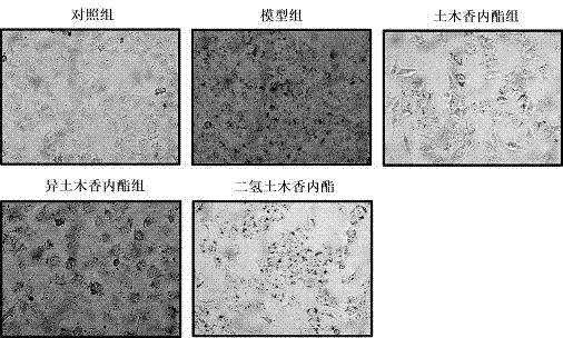 Application of alantolactone and derivatives thereof in preventing and treating fatty liver damage