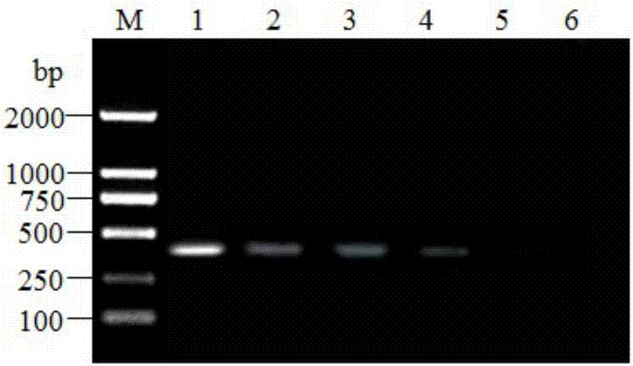 Triple RT-PCR primer composition for identification of H4 subtype, H6 subtype and H9 subtype AIV, and kit and use thereof