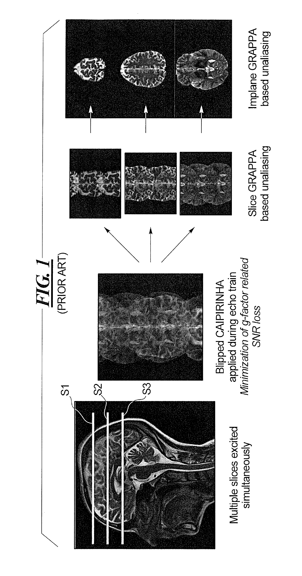 Magnetic resonance apparatus and method for simultaneous multi-contrast acquisition with simultaneous multislice imaging
