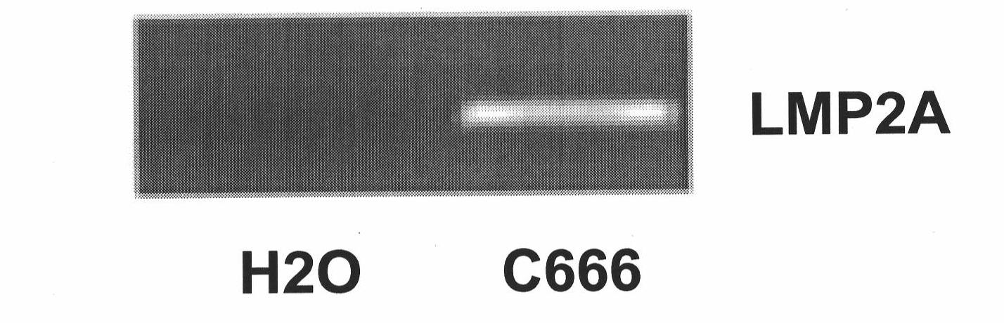 Preparation method and applications of anti-latent membrane protein LMP2A monoclonal antibody