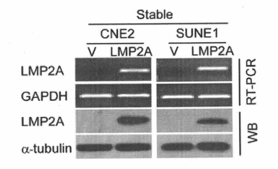 Preparation method and applications of anti-latent membrane protein LMP2A monoclonal antibody