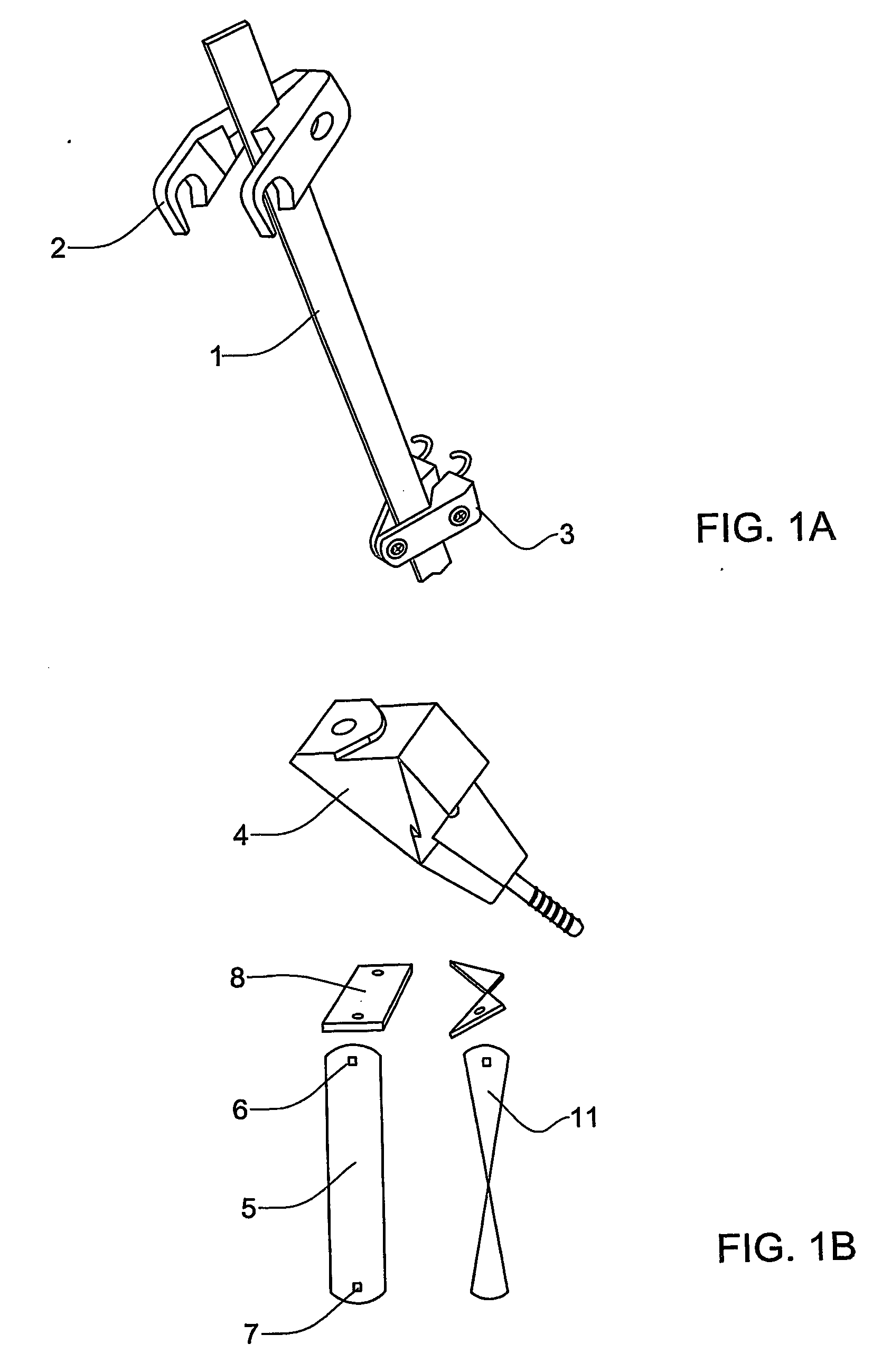 Implant for treating idiopathic scoliosis and a method for using the same