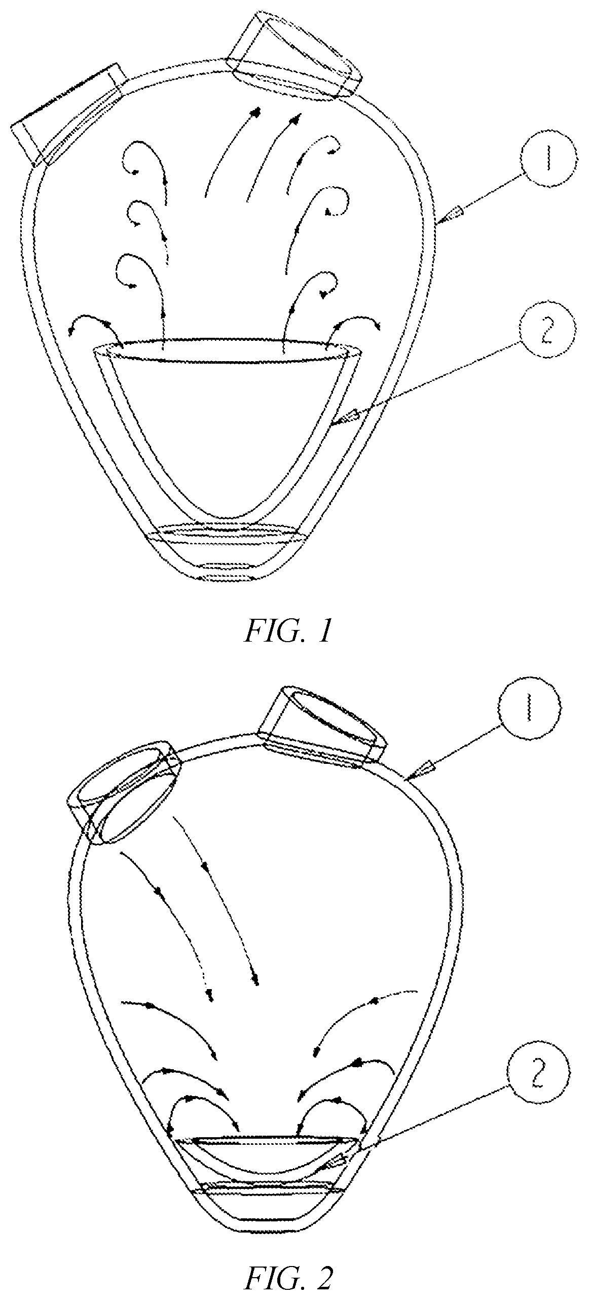 Intraventricular pulsating blood pump