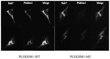 New mutation-causing gene plekhm1 in osteopetrosis, its encoded protein and its application