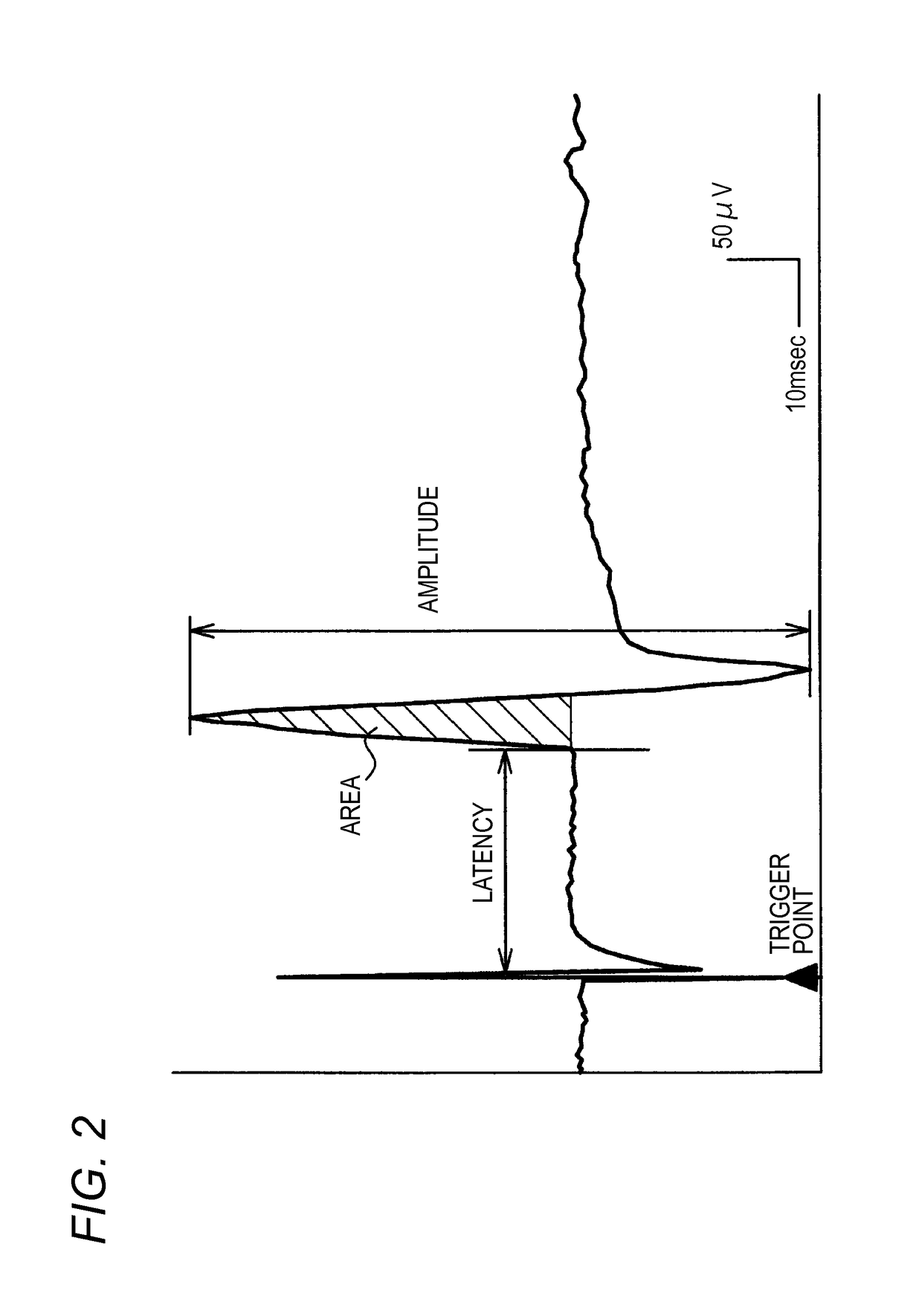 Biological signal display apparatus