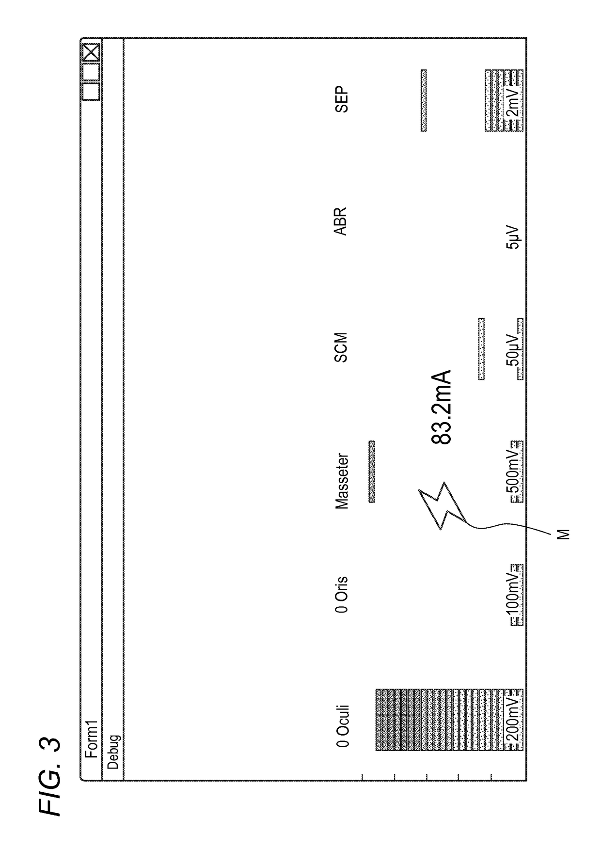 Biological signal display apparatus