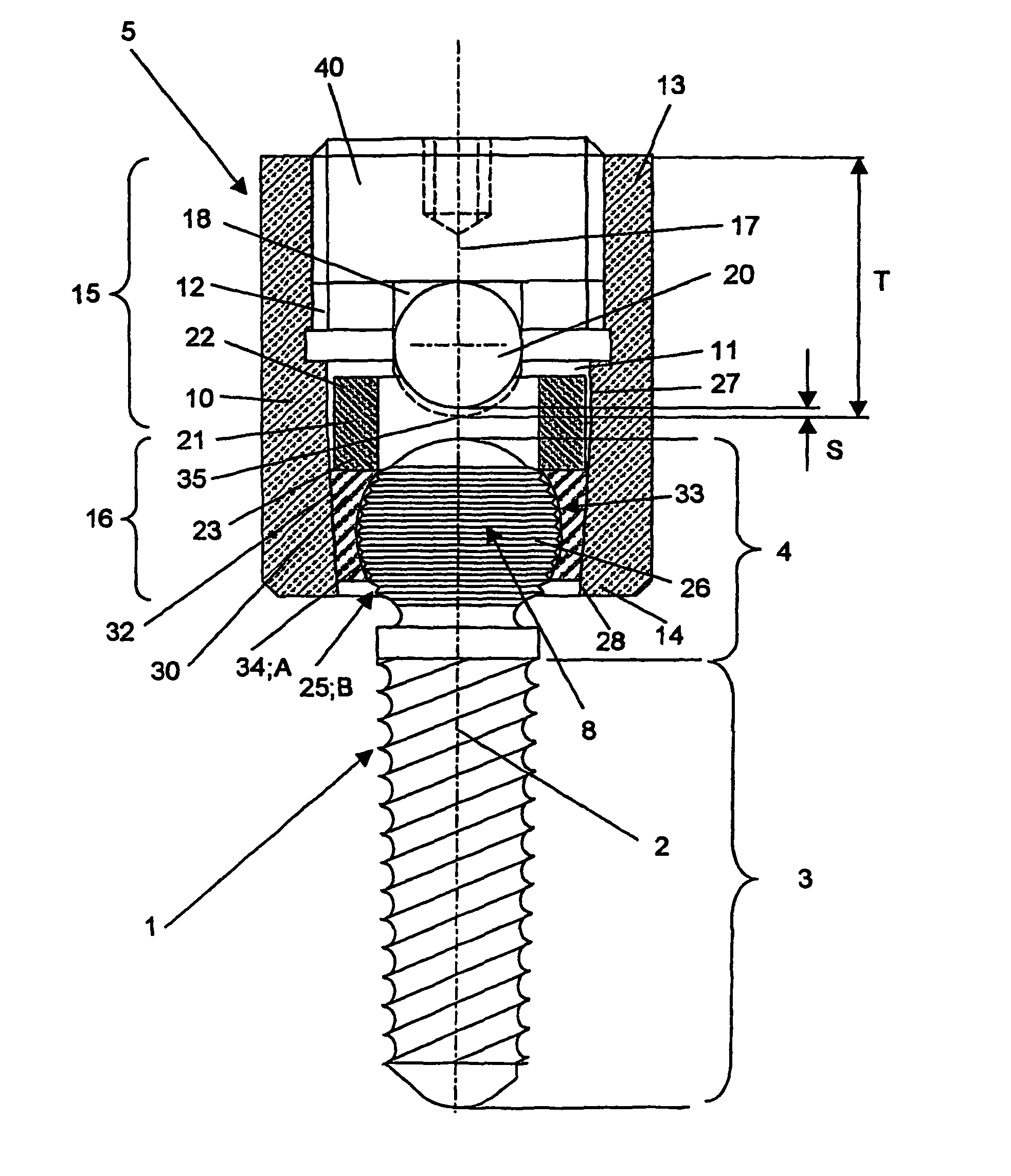 Device for the dynamic fixation of bones