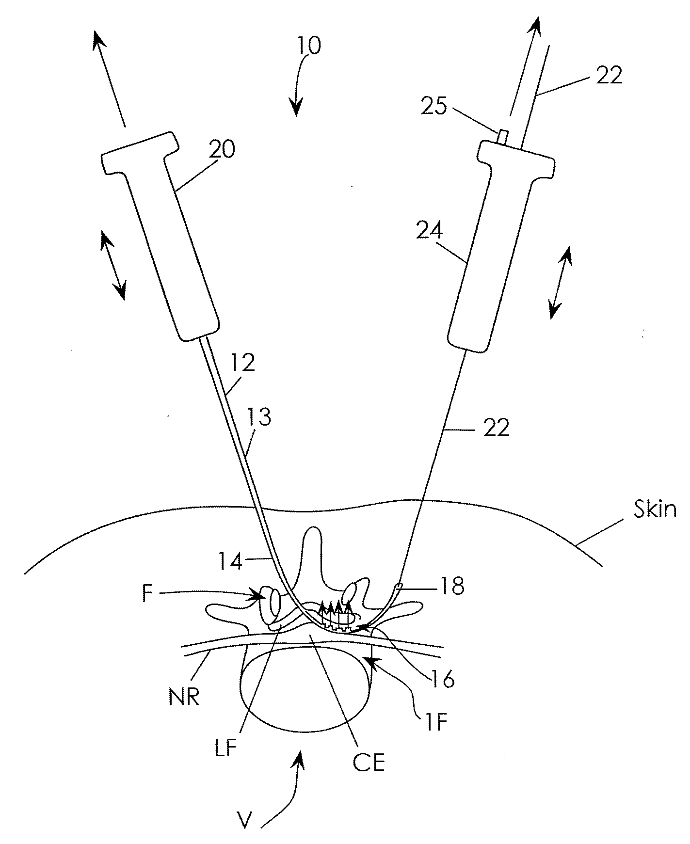 Devices and methods for measuring the space around a nerve root