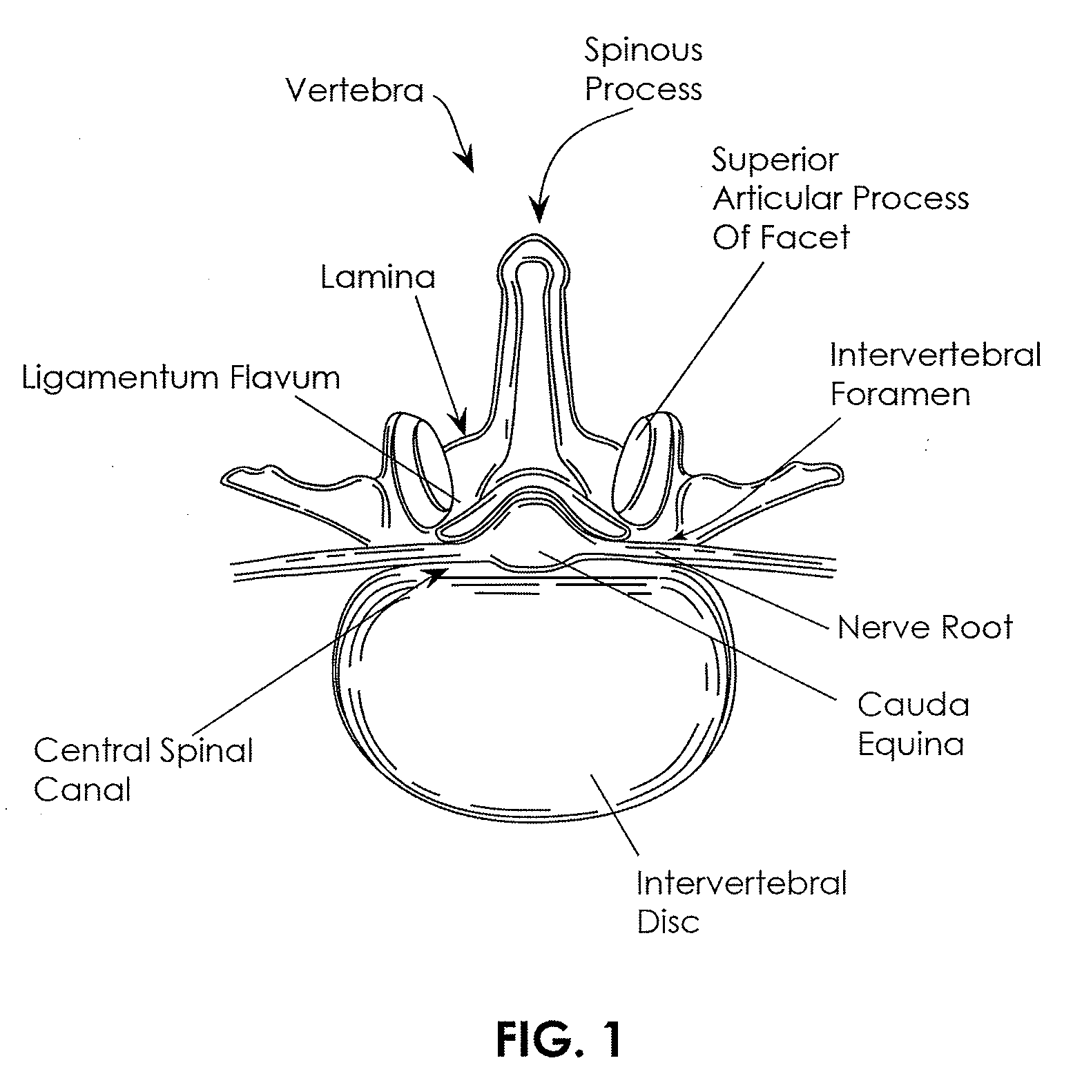 Devices and methods for measuring the space around a nerve root