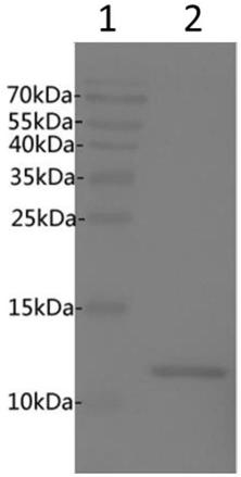 Anti-human beta2-microglobulin antibody and application thereof