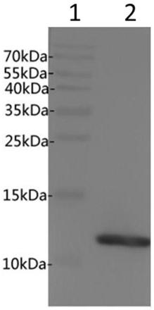 Anti-human beta2-microglobulin antibody and application thereof