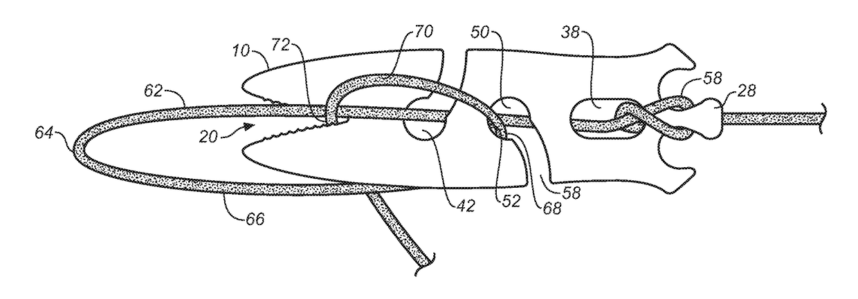 Rope tensioning and fastening device