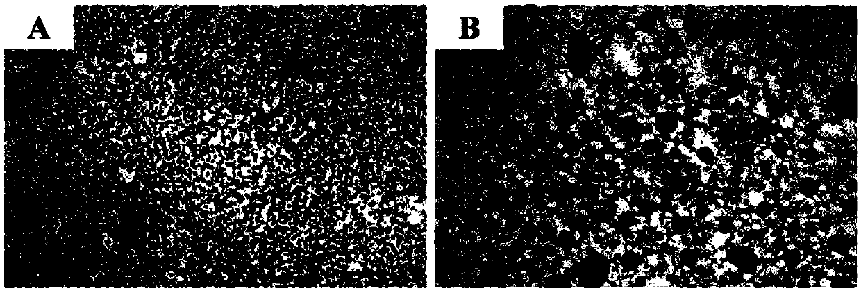 Method for rapidly screening small experimental fish to construct pancreatic fat infiltration model