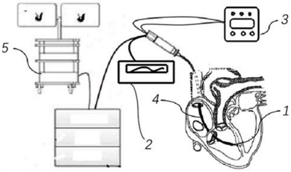 Ablation electrode assembly and ablation catheter