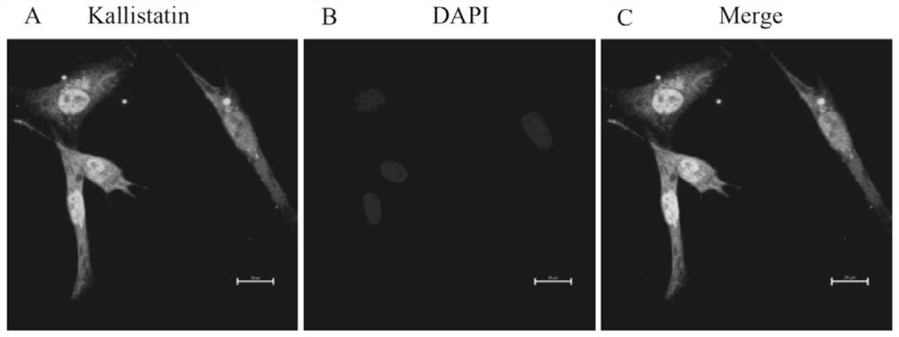 Diagnosis marker kallistatin for ovarian hyperstimulation syndrome and its application