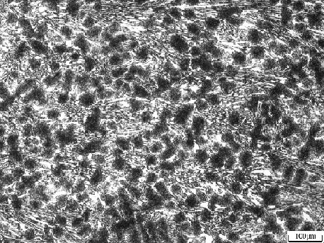 An improved high chromium ferroroller with tungsten modification treatment