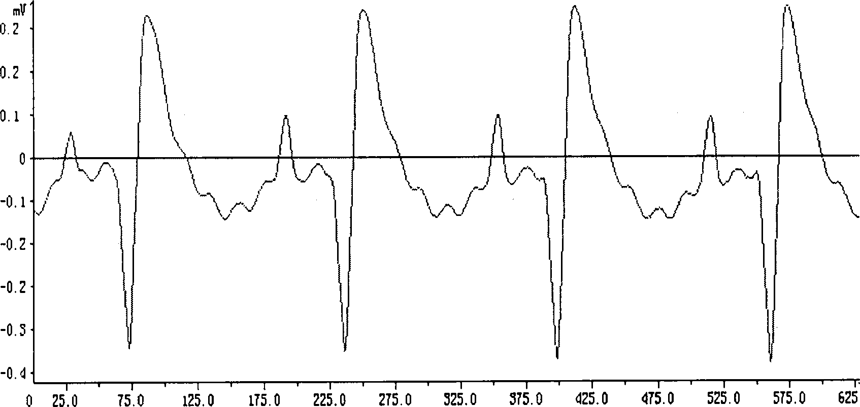 Application of coptisine in preventing and curing myocardial ischemic diseases