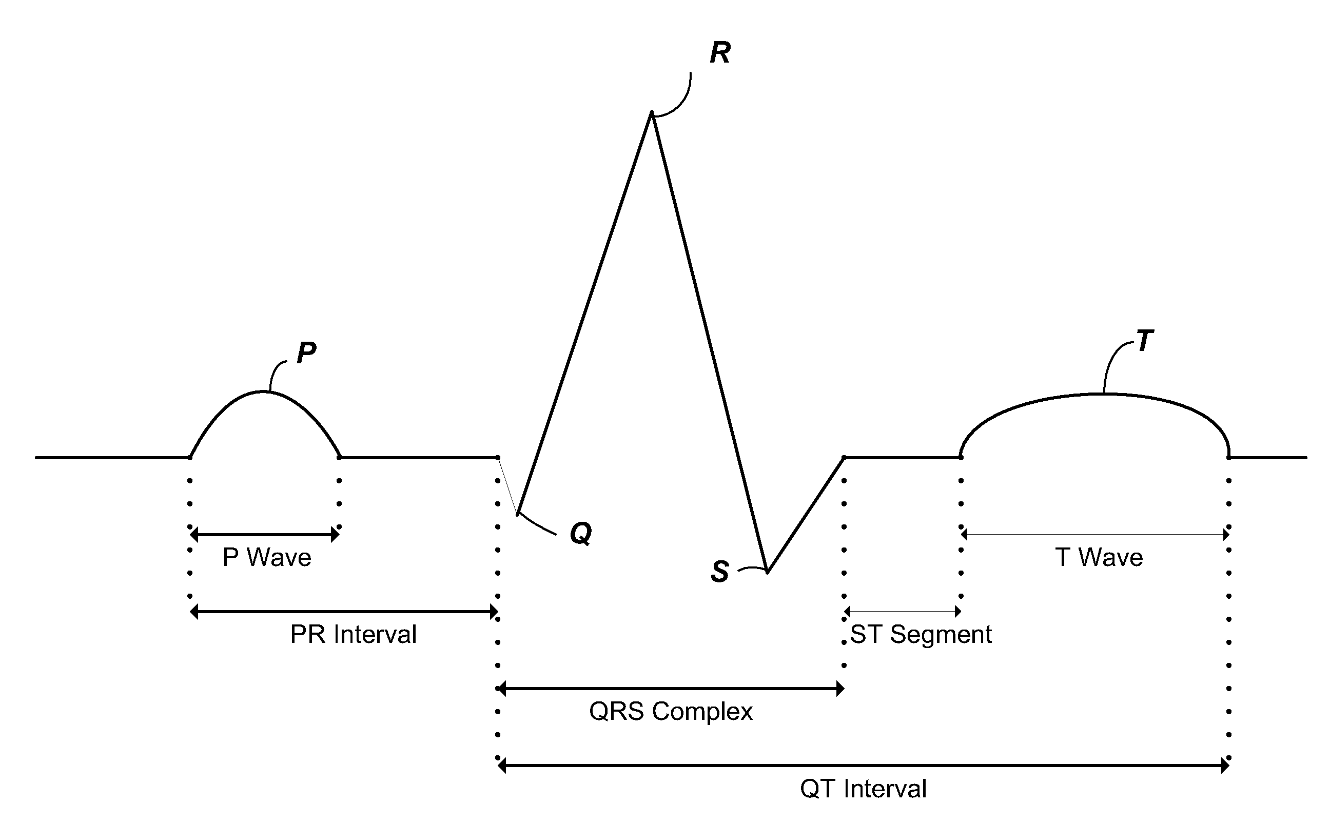 Method, apparatus and protocol for screening appropriate patient candidates and for cardiac resychronization therapy (CRT), determining cardiac functional response to adjustments of ventricular pacing devices and follow-up of CRT patient outcomes