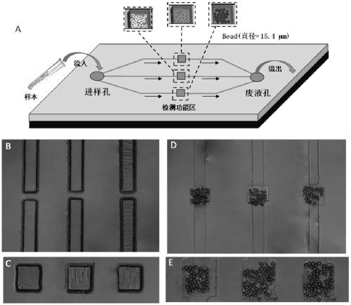 Circulating nucleic acid detection kit based on microfluidic microbead array chip and application method thereof