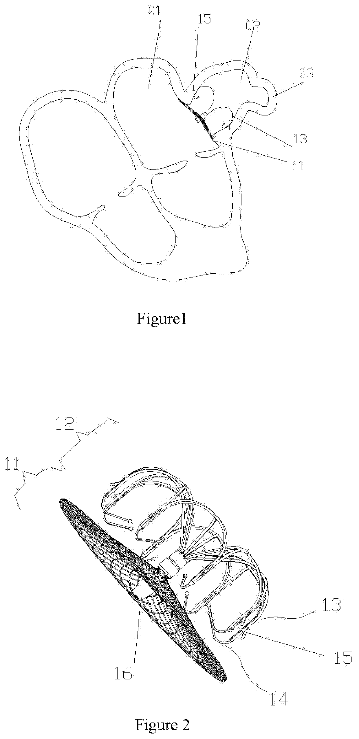 Left atrial appendage occluder