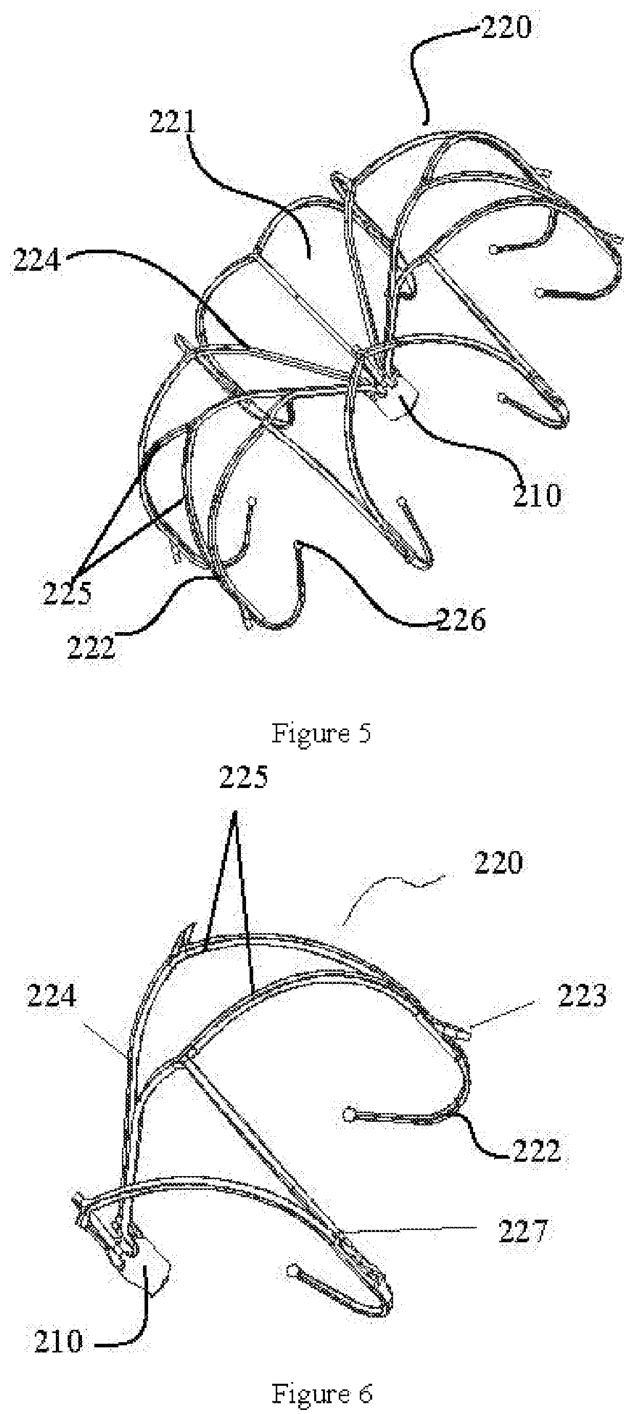 Left atrial appendage occluder