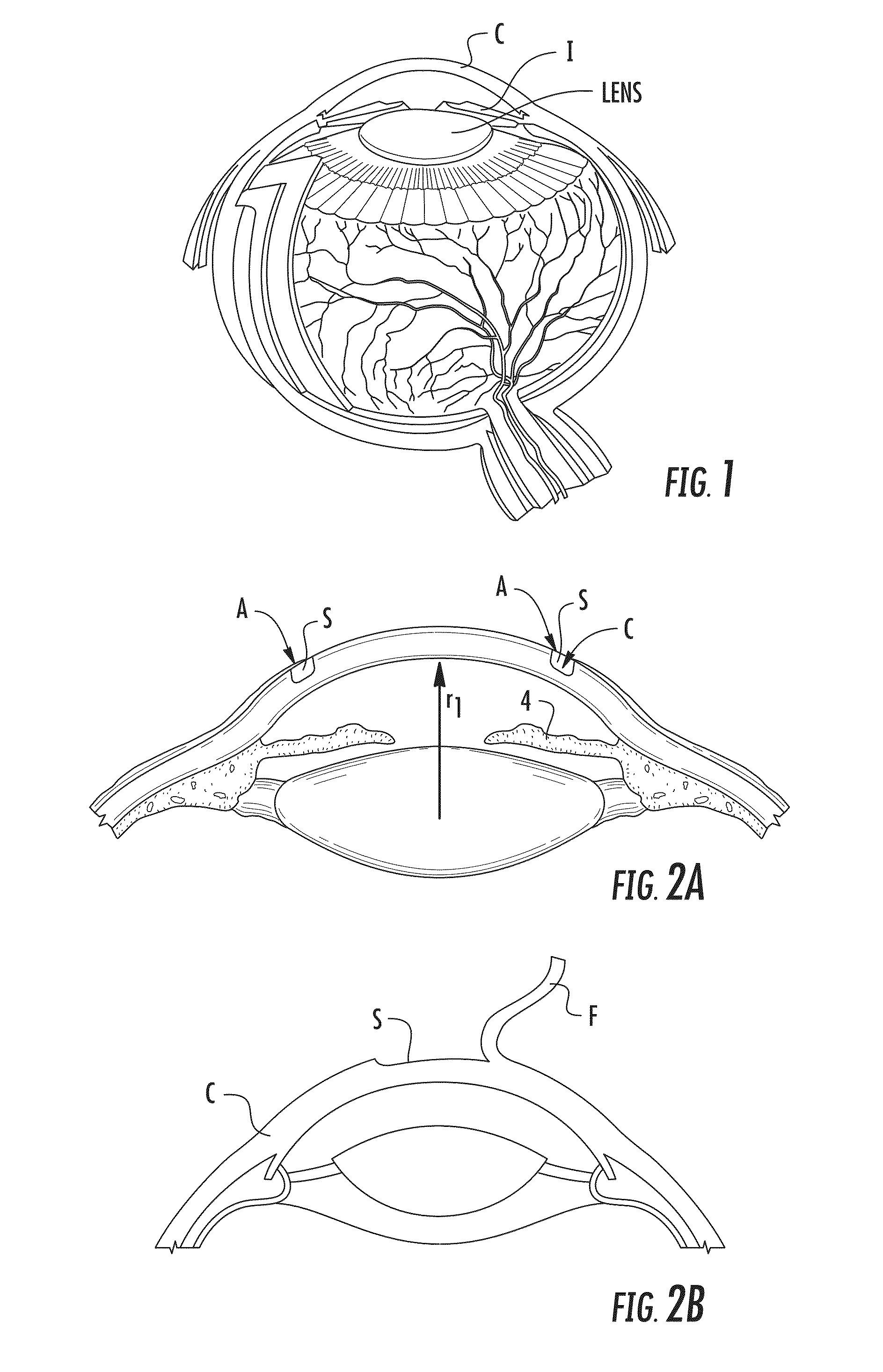 Surgical tools and systems for corneal tattooing and related methods