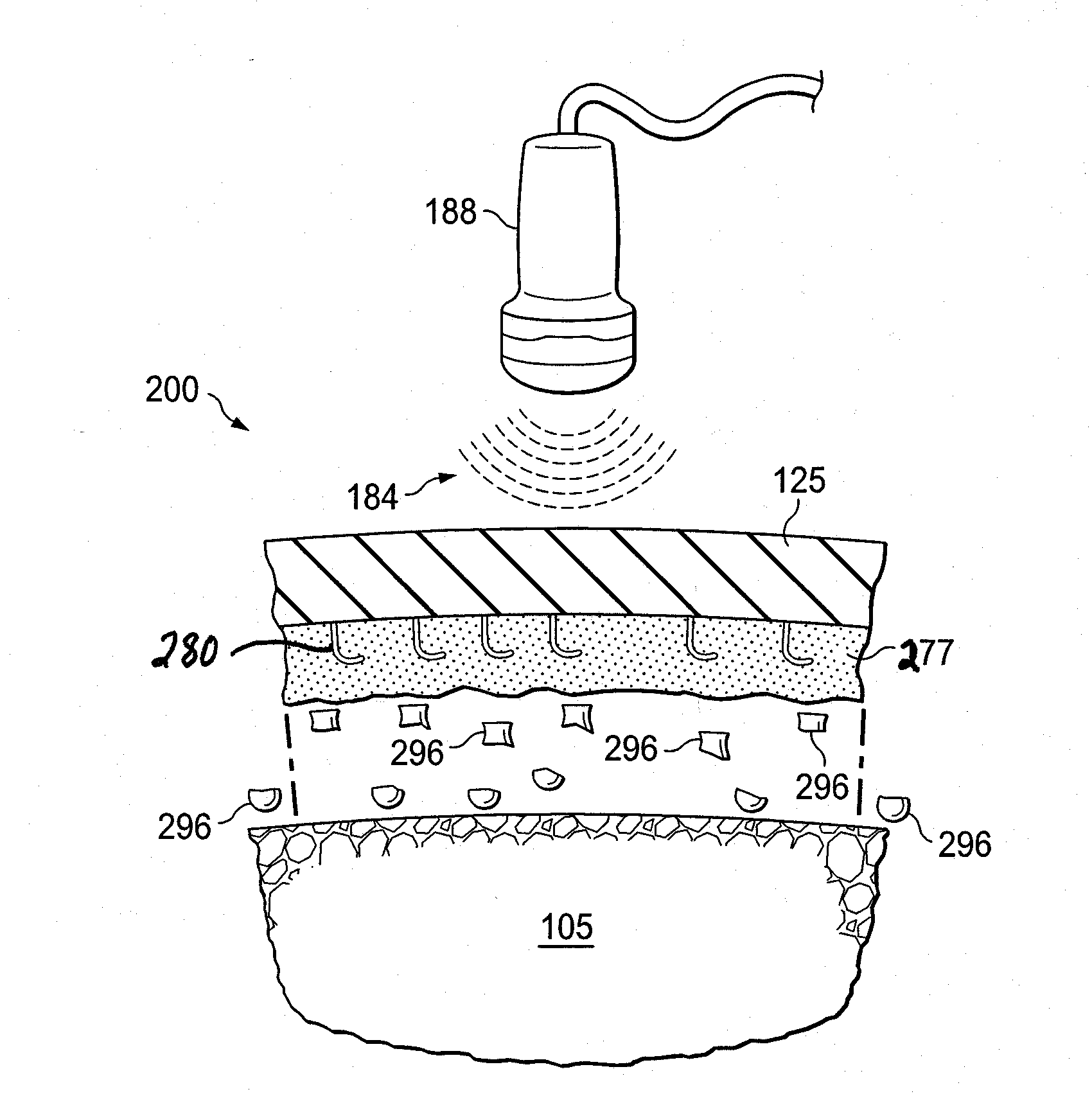 System and method for healing a wound at a tissue site