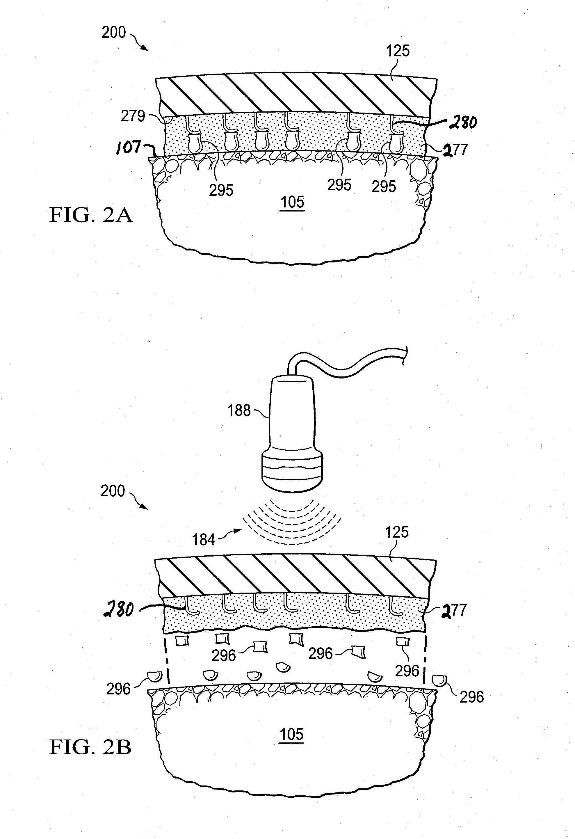 System and method for healing a wound at a tissue site