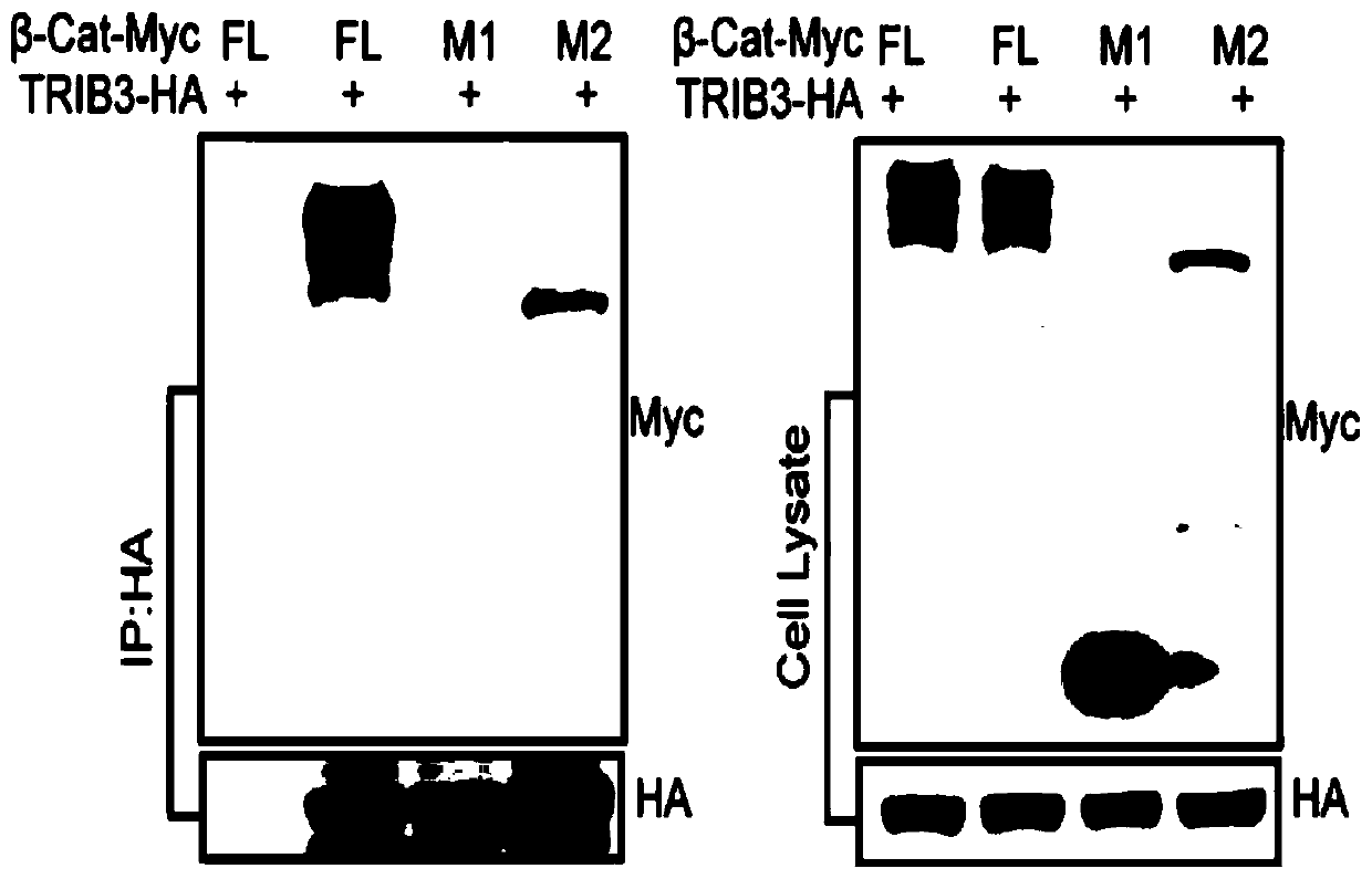 Polypeptide targeting to inhibit Wnt/beta-catenin signal activity and application thereof