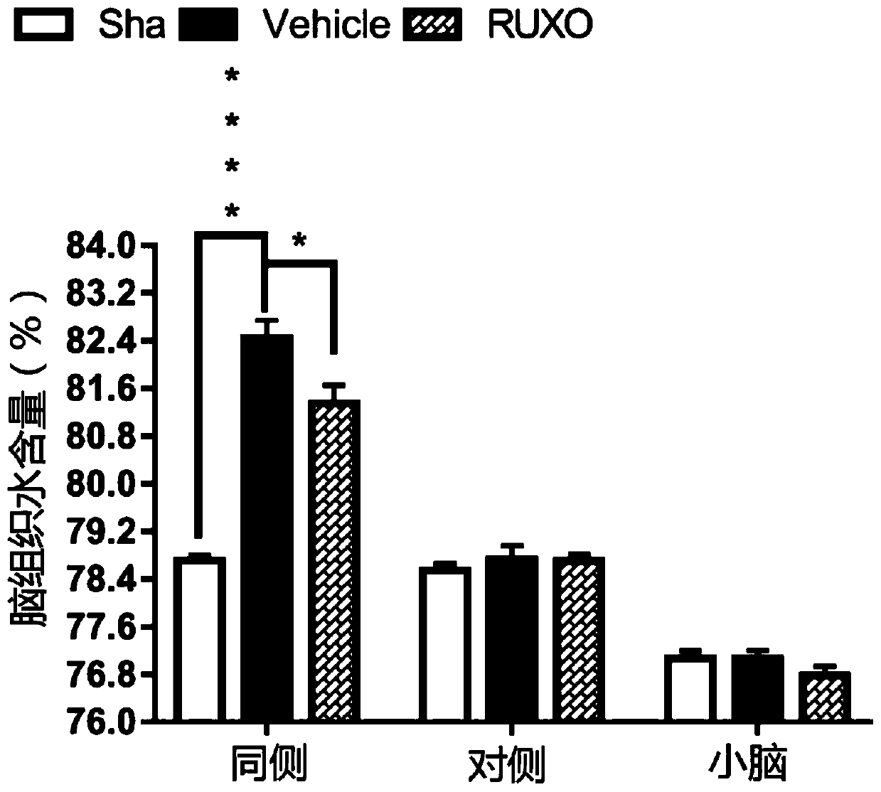 Application of JAK-1 signal pathway inhibitor in preparation of medicine for treating brain injury