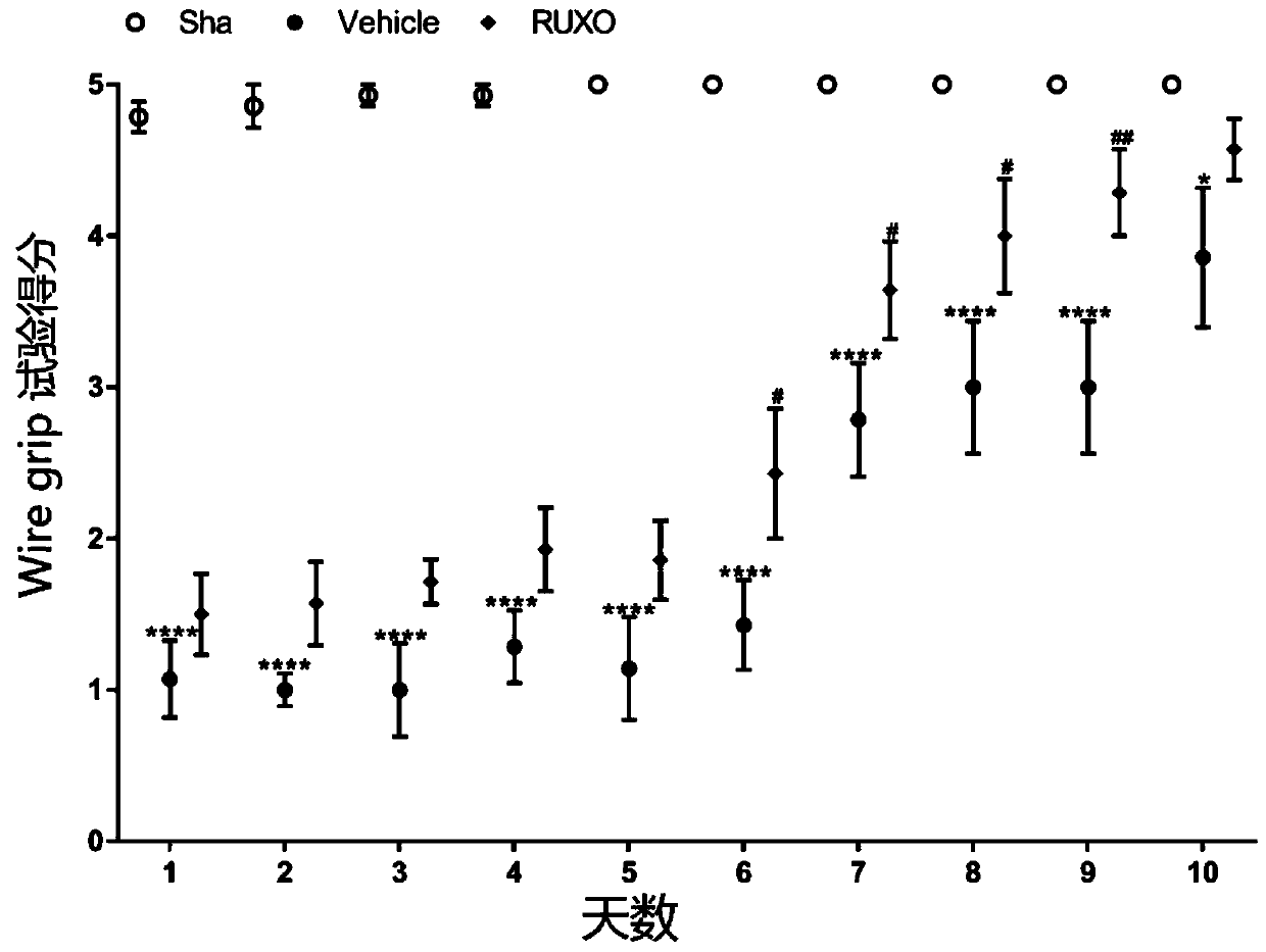 Application of JAK-1 signal pathway inhibitor in preparation of medicine for treating brain injury