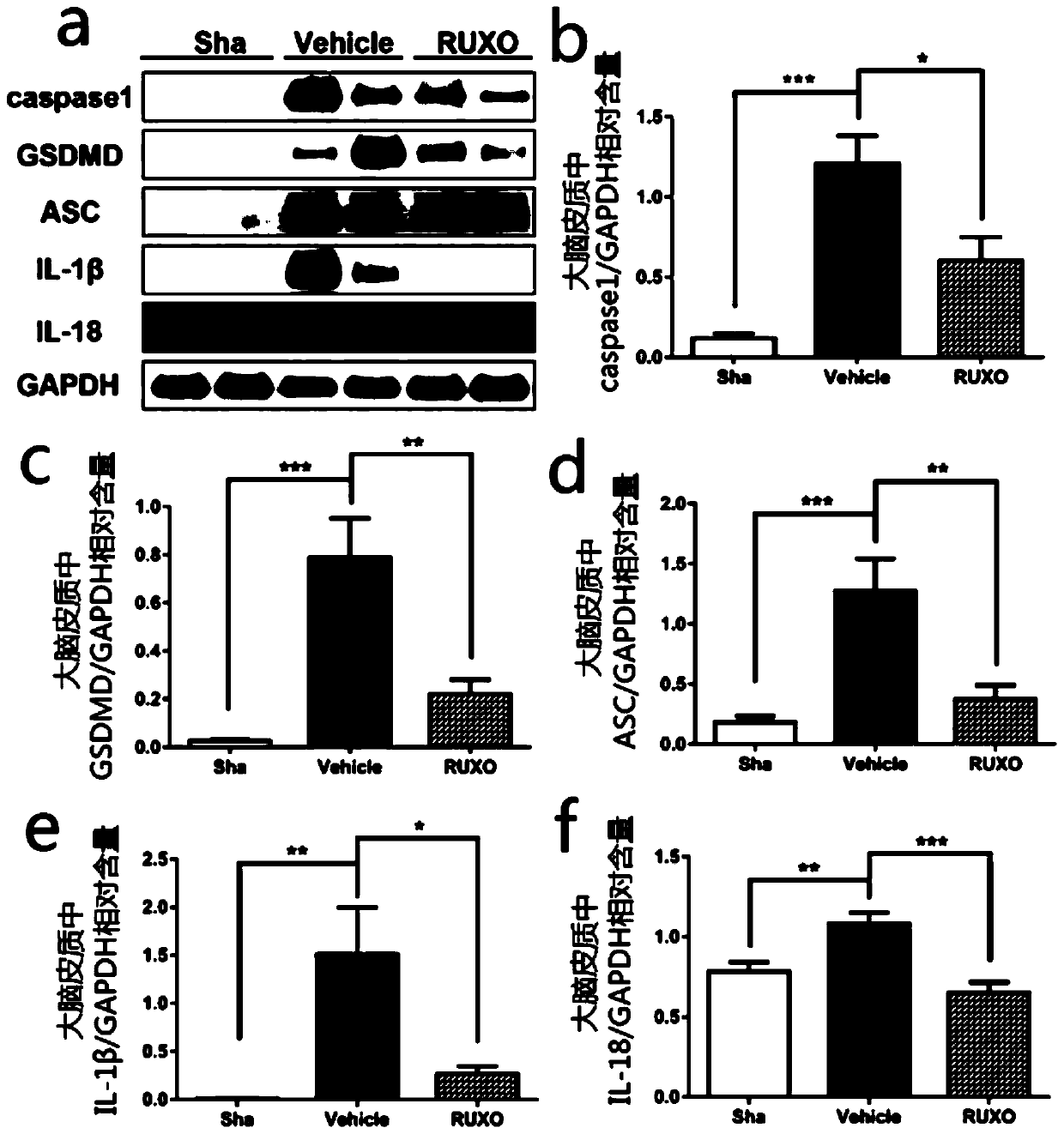 Application of JAK-1 signal pathway inhibitor in preparation of medicine for treating brain injury