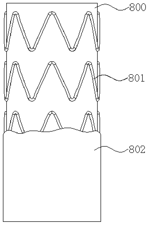 Stent Graft