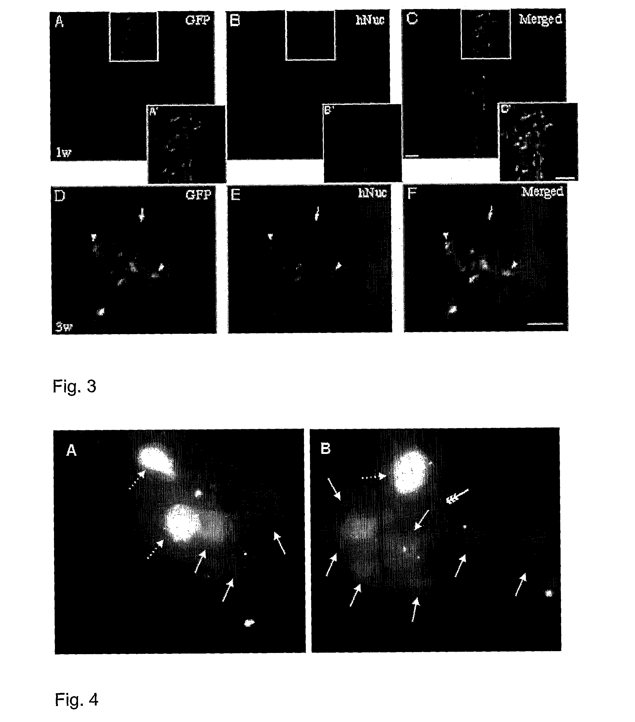 Human immortalised neural precursor cell line