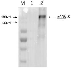 Replication-defective Ad29 adenovirus vector as well as construction method and application thereof