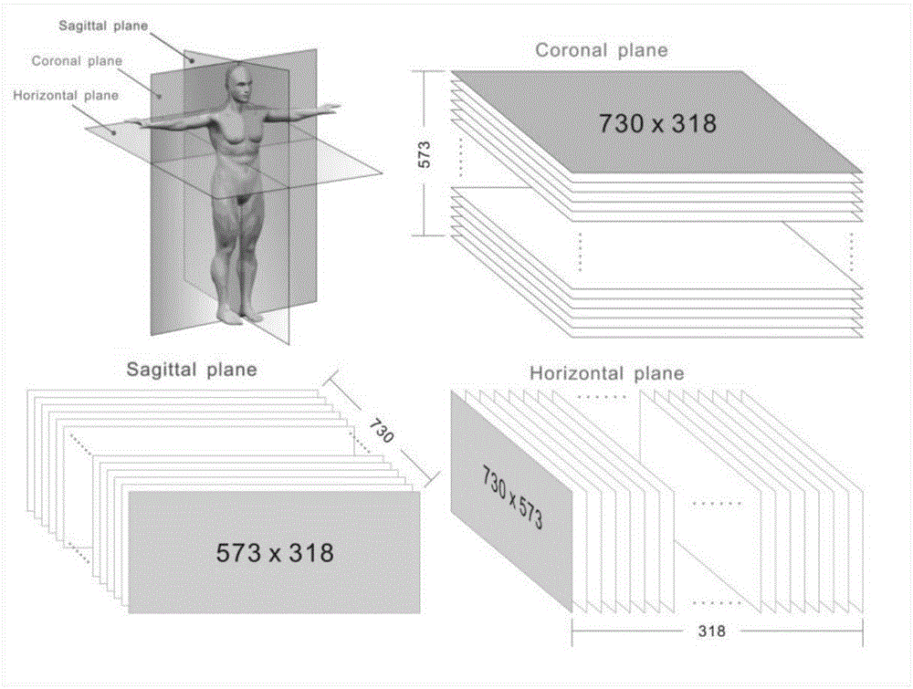 Automatic extraction method of three-dimensional breast full-volume image regions of interest