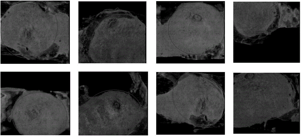 Automatic extraction method of three-dimensional breast full-volume image regions of interest