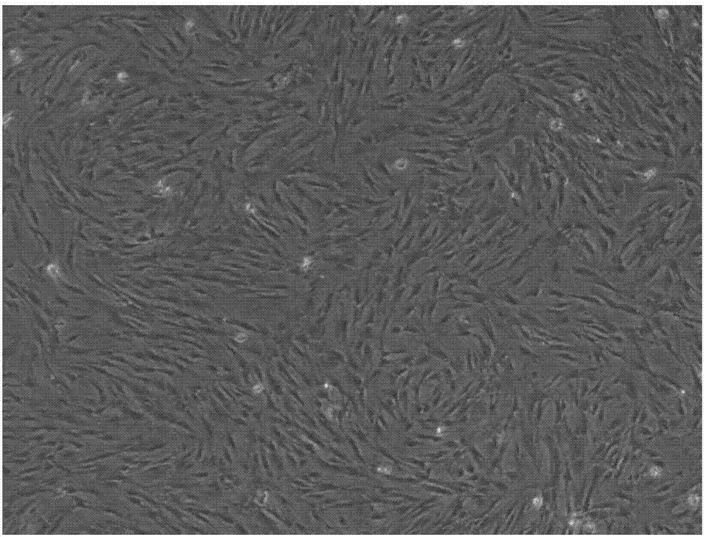 Preparation method and application of exosome derived from human olfactory mucosa mesenchymal stem cells