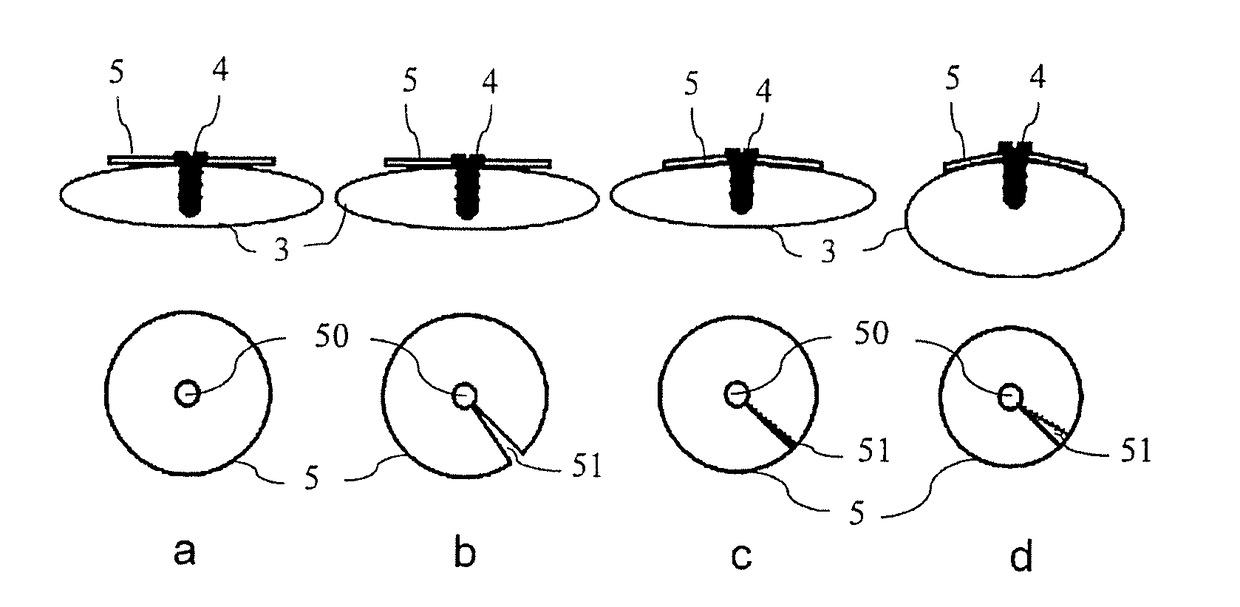 Electrode and Electrode Pad for the Electrical Stimulation of Brain Tissue or other tissue of a Patient