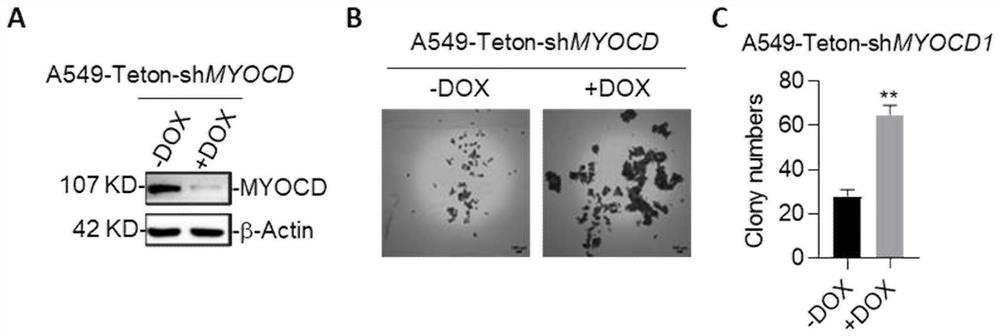 Combination drugs for the treatment of kras mutation and myocd loss of function lung cancer