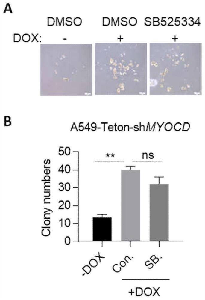 Combination drugs for the treatment of kras mutation and myocd loss of function lung cancer